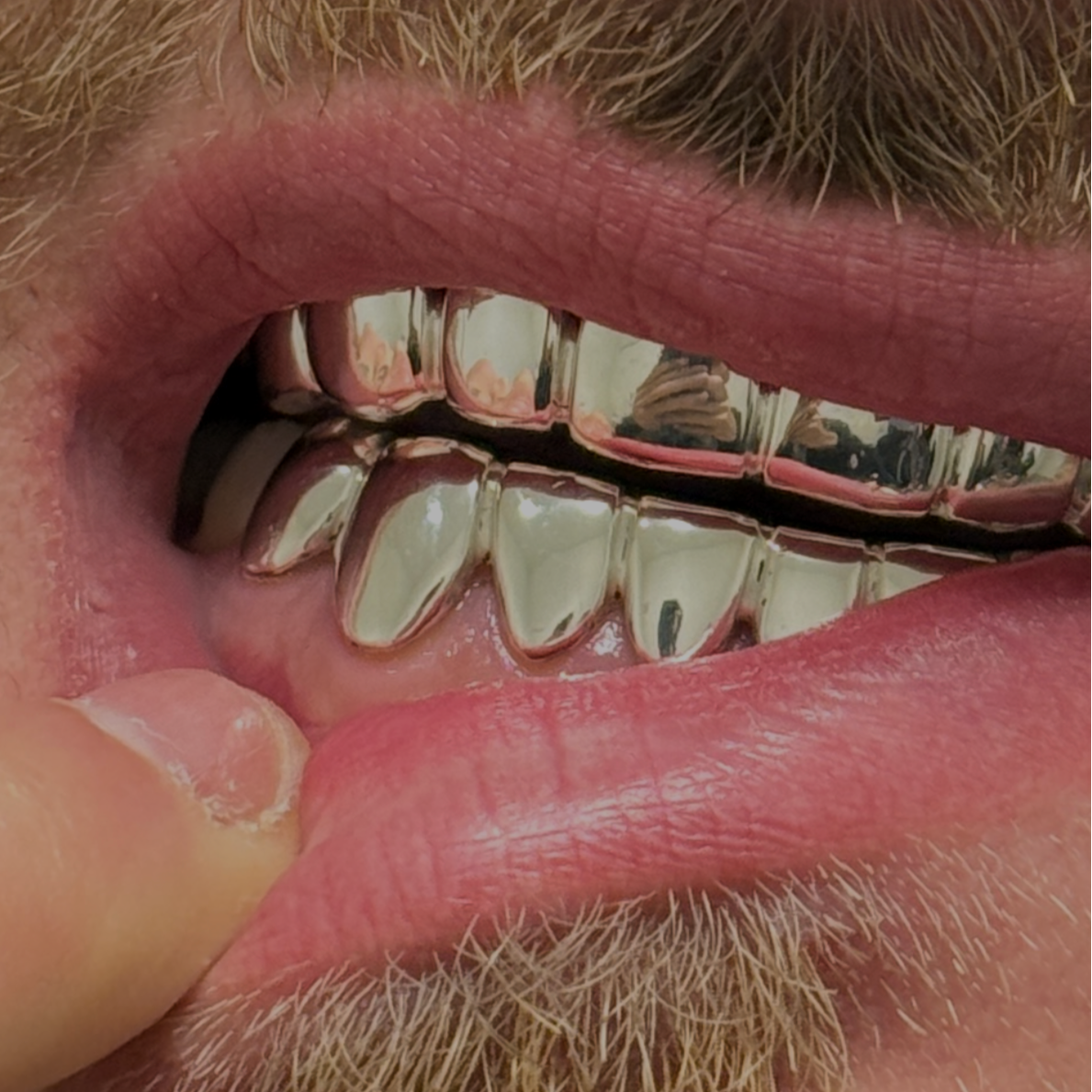 Full Set Grillz